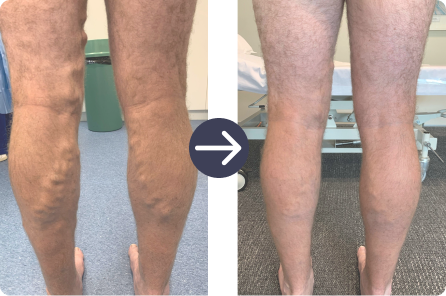 Male patient before and after treatment